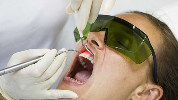 Minimally Invasive Dental Treatments Bloomfield Hills, MI