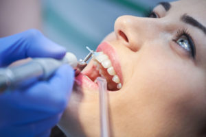 Patient Undergoing Dental Procedure