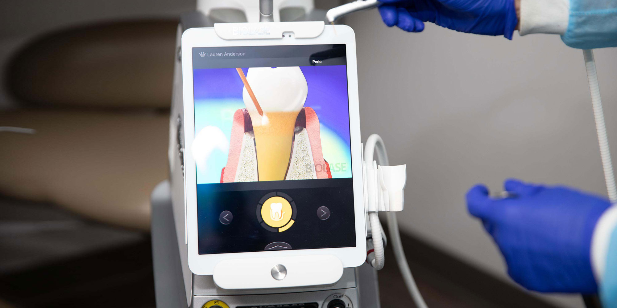 Laser Gum Disease Treatment Bloomfield Hills, MI