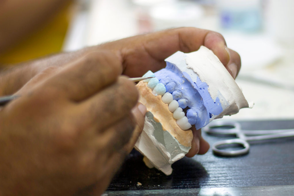 full mouth dental implants being molded milled and painted.