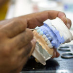 full mouth dental implants being molded milled and painted.