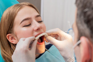 a dental patient improving the look and function of her smile with a full arch prosthesis during her full mouth dental implant procedure.