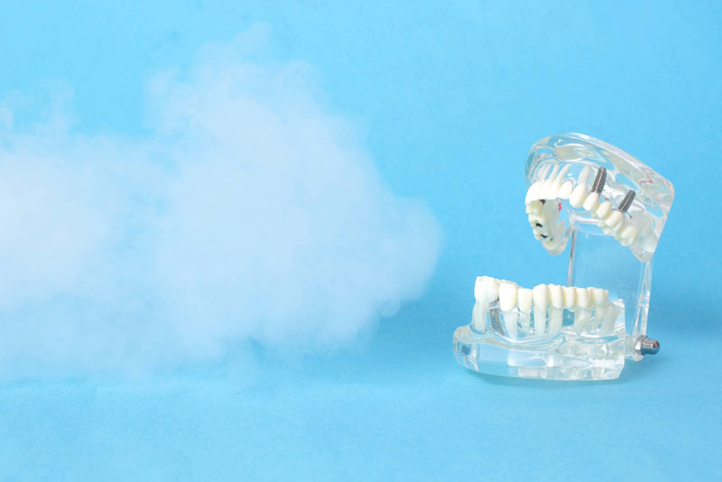 ozone therapy with a dental implant full arch model
